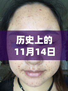 历史上的11月14日，最新祛斑方法与小巷深处的秘密大揭秘！