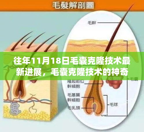 毛囊克隆技术揭秘，生日遇上的科技奇迹之旅