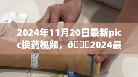 2024年最新PICC换药视频教程与实操指南