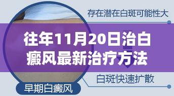 往年11月20日白癜风最新治疗方法深度解析，探寻新路，助力白癜风治疗评测与进展