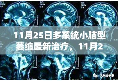 11月25日多系统小脑型萎缩最新治疗及步骤指南