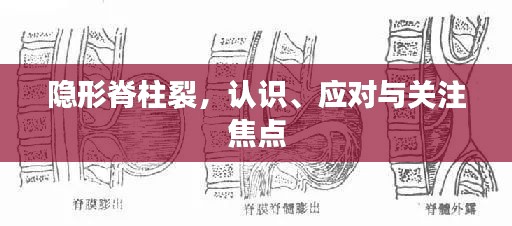 隐形脊柱裂，认识、应对与关注焦点