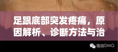 足跟底部突发疼痛，原因解析、诊断方法与治疗策略