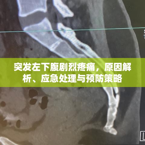 突发左下腹剧烈疼痛，原因解析、应急处理与预防策略